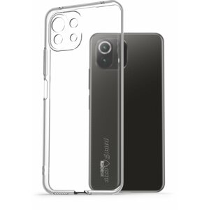 Telefon tok AlzaGuard Crystal Clear TPU Case Xiaomi Mi 11 Lite / 11 Lite 5G NE tok